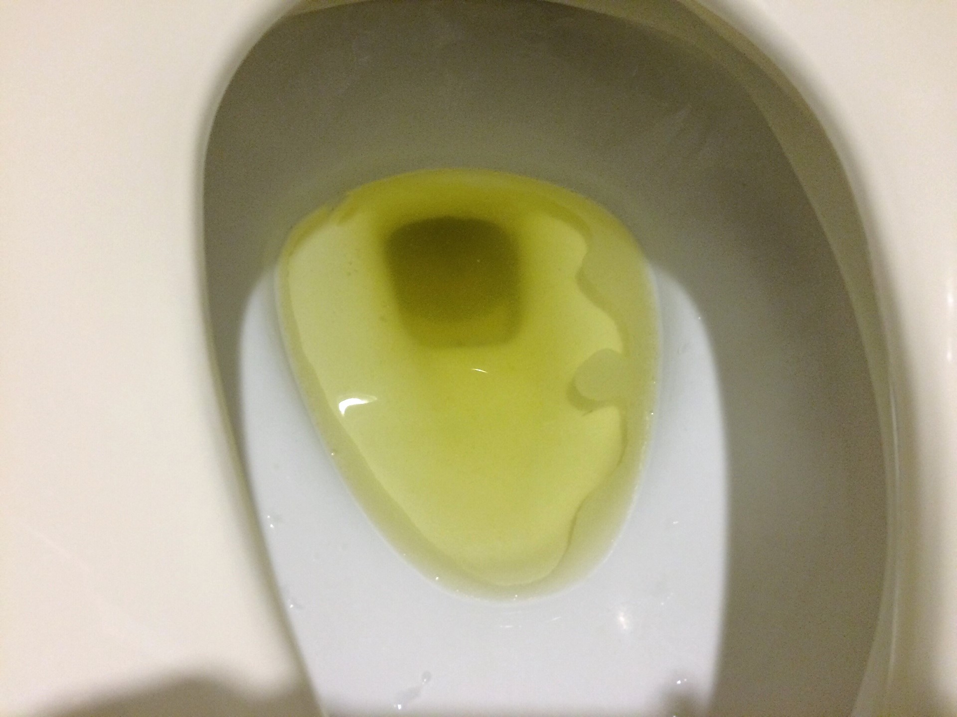 大腸内視鏡検査の準備のために下剤を服用した後の便
