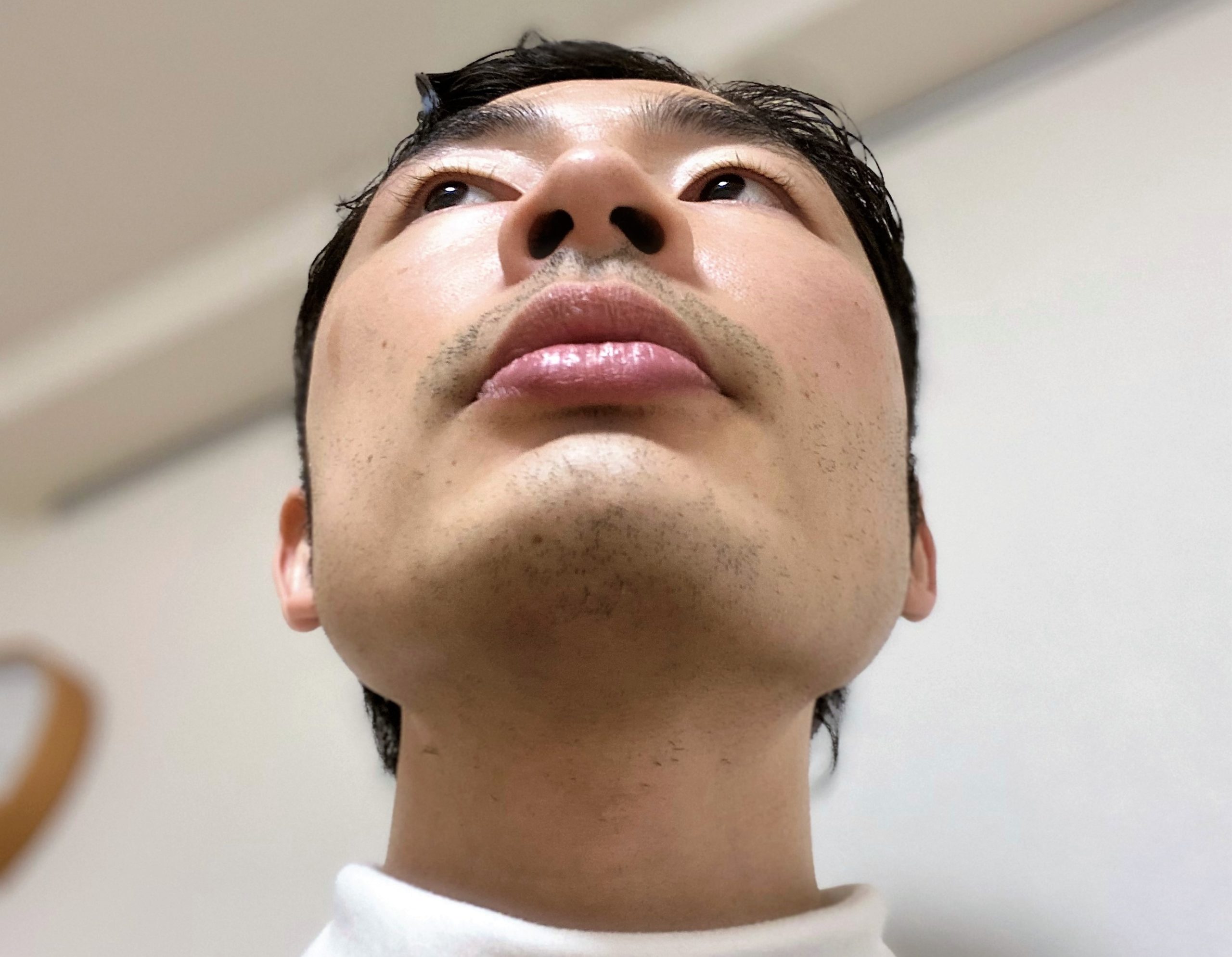 ヒゲ脱毛再生