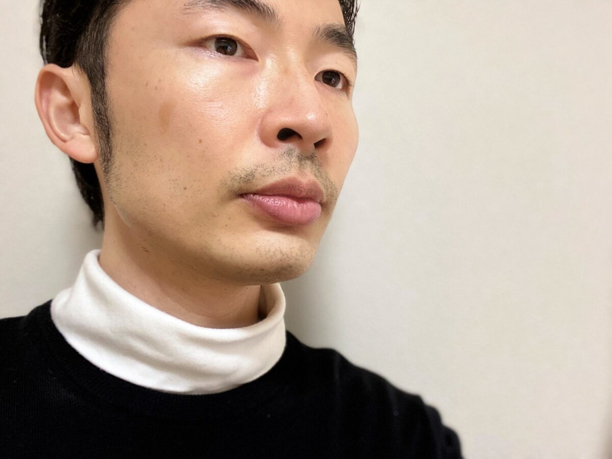 ヒゲ脱毛再生