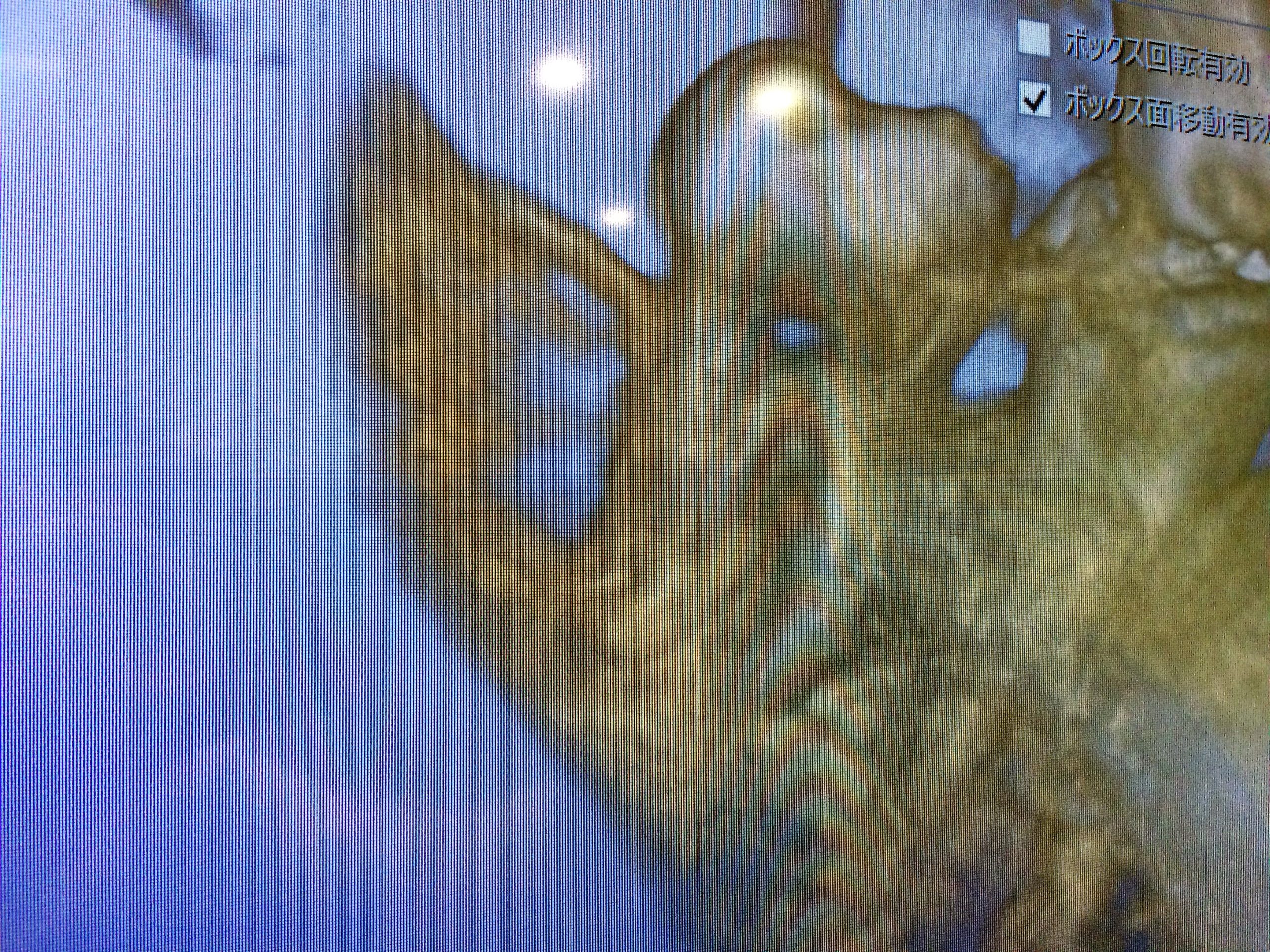 親知らず抜歯CT
