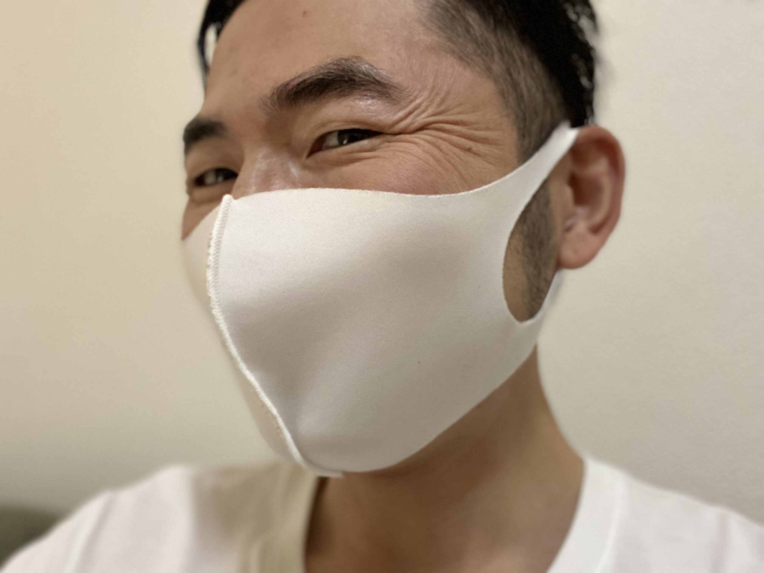 シワ取り治療カウンセリング