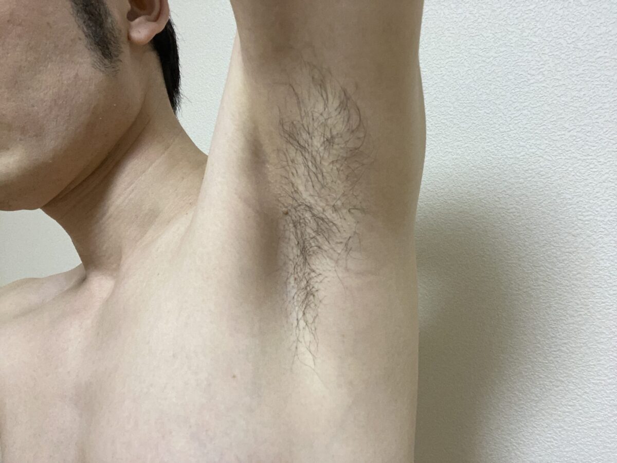 メンズわき脱毛の感想
