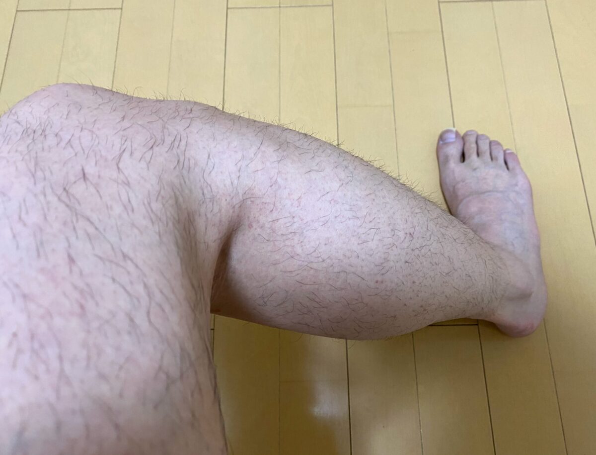 男の全身脱毛1回目の効果