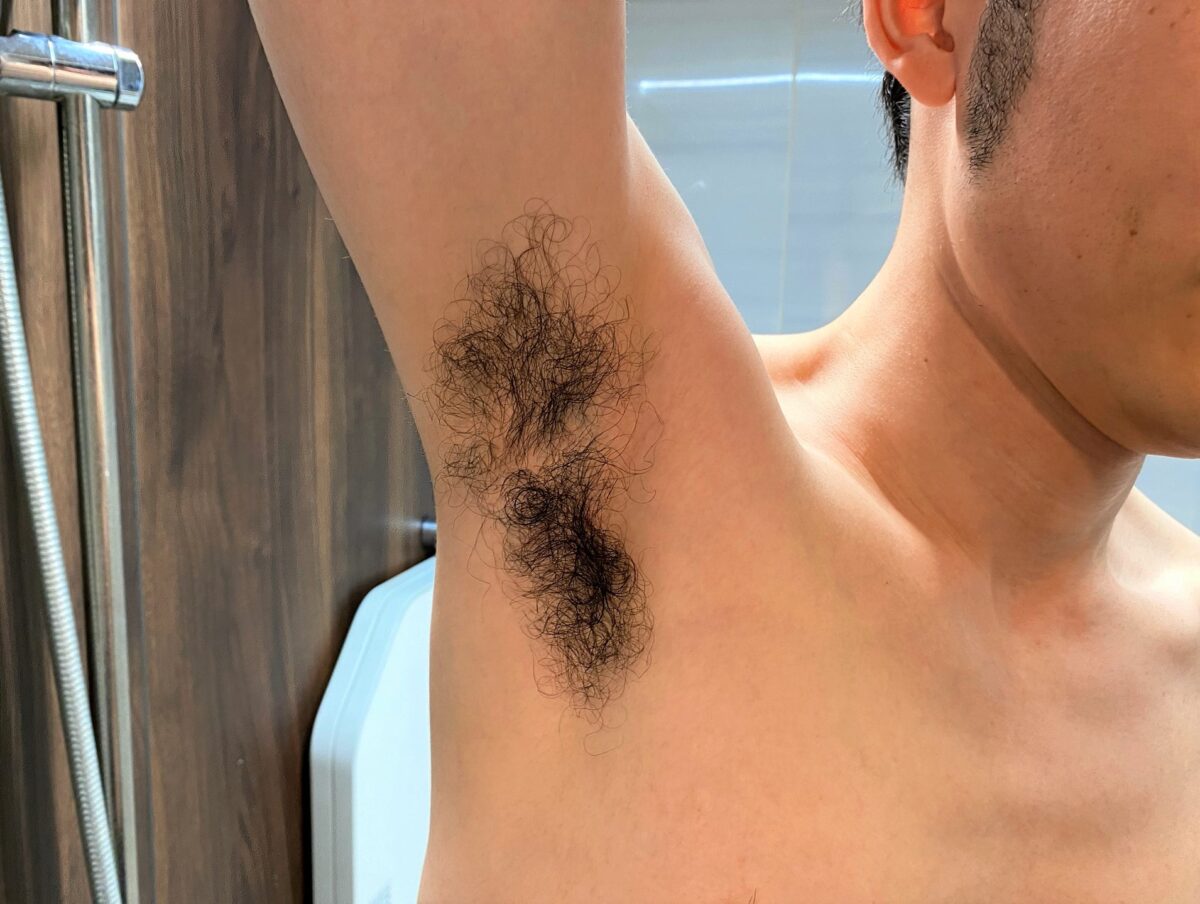 男の全身脱毛前のわき