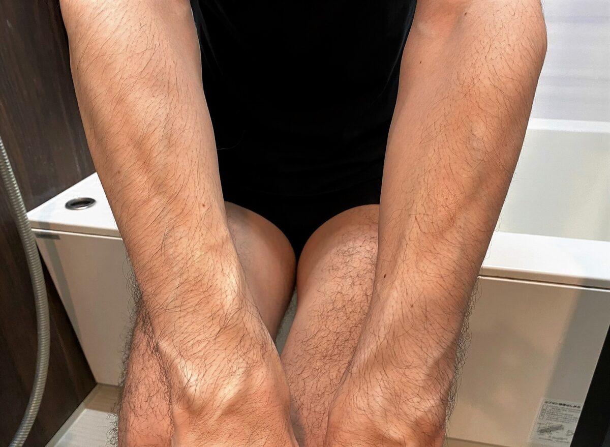 男の全身脱毛前の腕