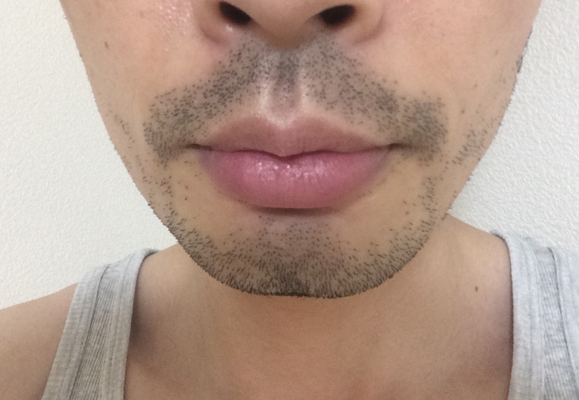 https://iryowriter.net/beard-hair-removal-effective-machine/