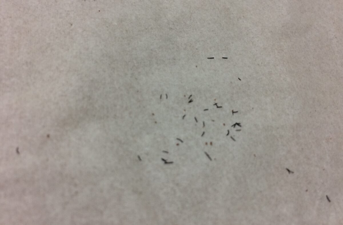 ヒゲ脱毛でツルツルになるまで