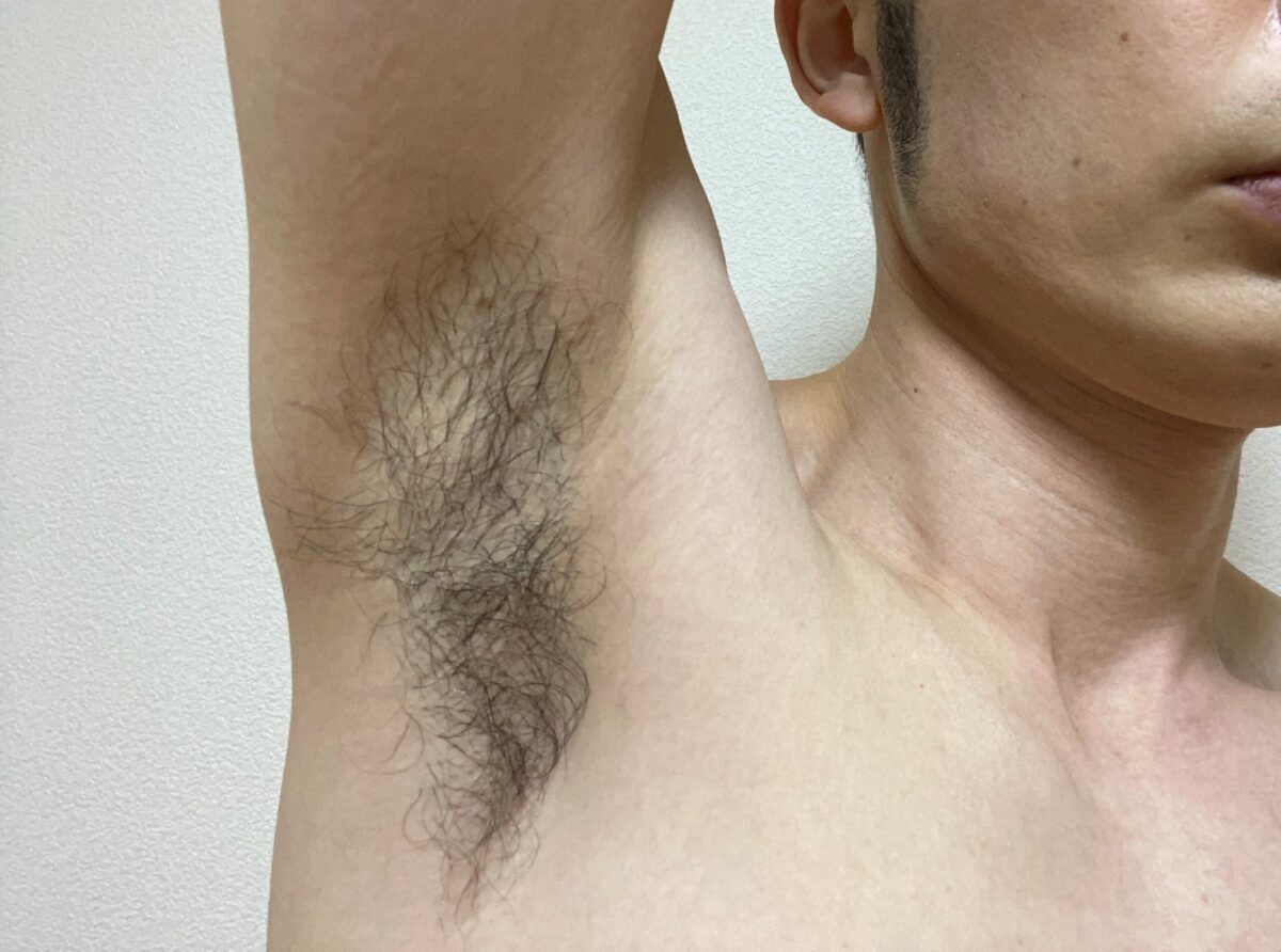 メンズわき脱毛の感想