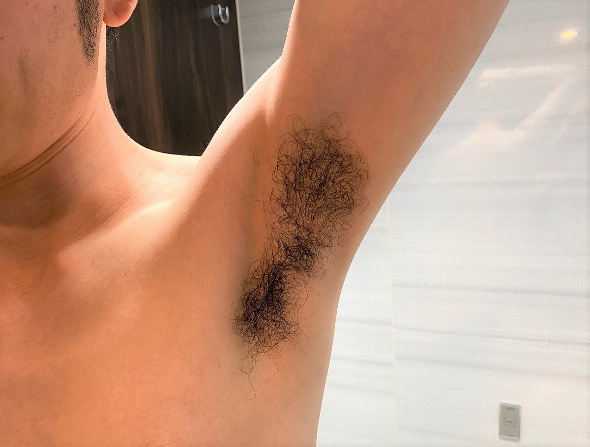 男の全身脱毛開始前