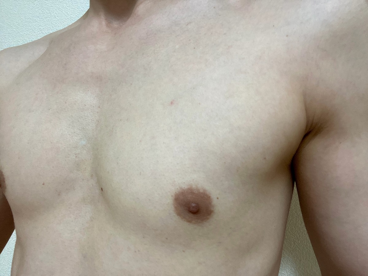 男の全身脱毛前2回目の効果