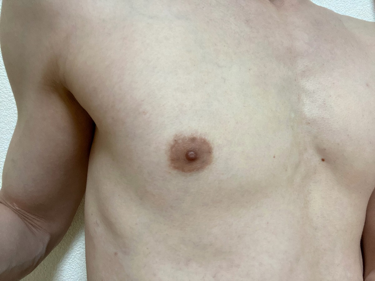 男の全身脱毛前2回目の効果