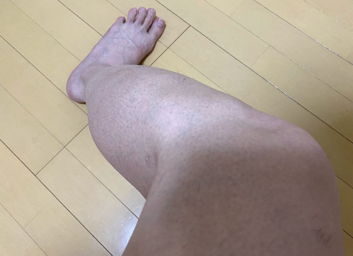男の全身脱毛前2回目の効果