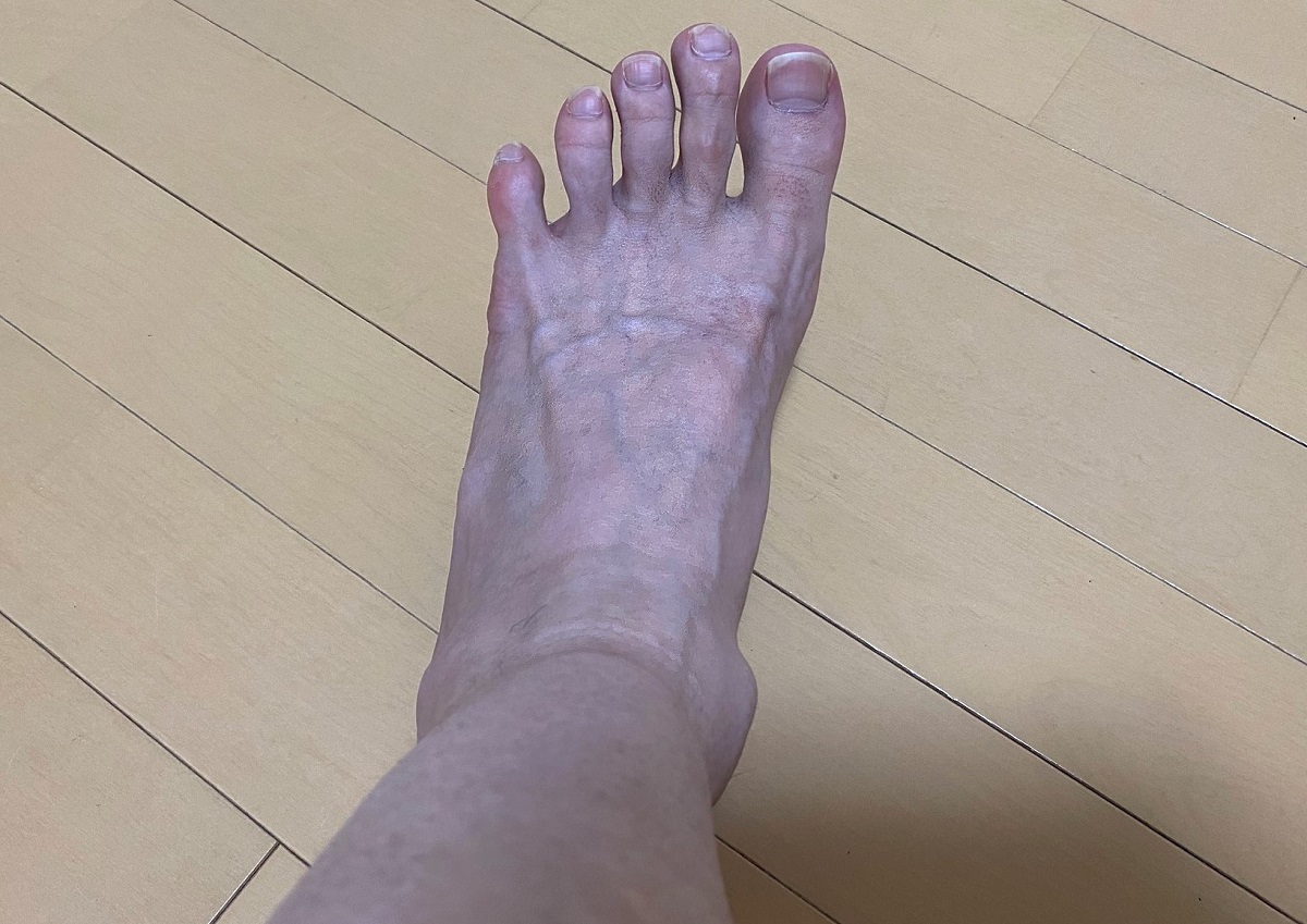 男の全身脱毛前2回目の効果