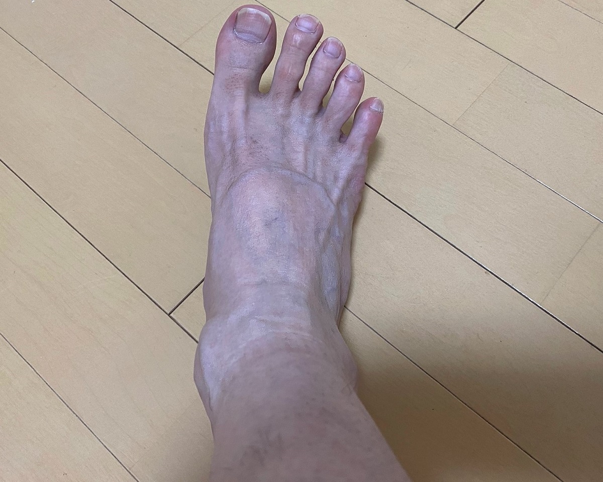 男の全身脱毛前2回目の効果