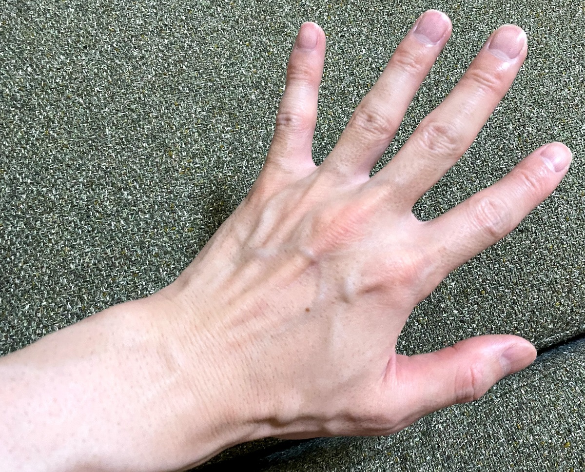 男の全身脱毛前2回目の効果