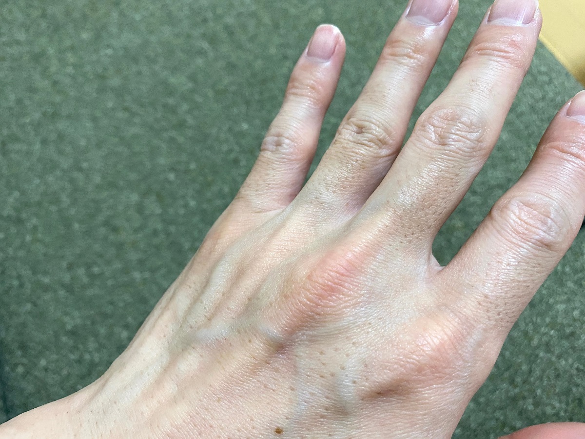 男の全身脱毛前2回目の効果