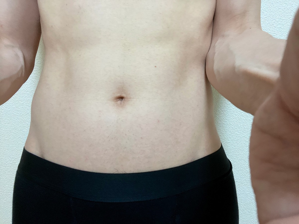 男の全身脱毛前2回目の効果