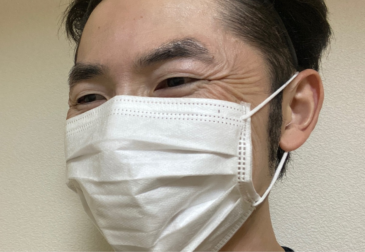 男の美容 目じりのシワをボトックスで減らした体験談 画像 医療ライター庄部勇太の取材ノート 男の美容 目じりのシワをボトックスで減らした体験談 画像 医療ライター庄部勇太の取材ノート