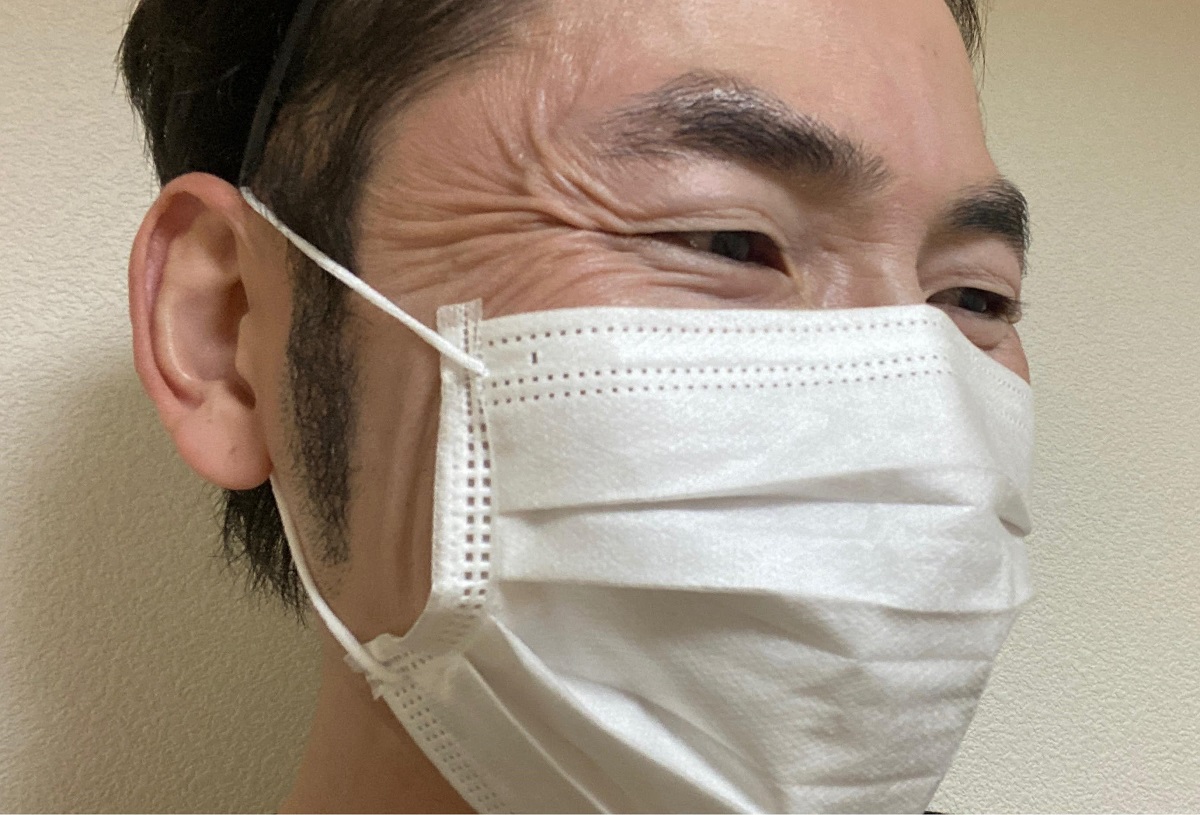 男の美容 目じりのシワをボトックスで減らした体験談 画像 医療ライター庄部勇太の取材ノート 男の美容 目じりのシワをボトックスで減らした体験談 画像 医療ライター庄部勇太の取材ノート