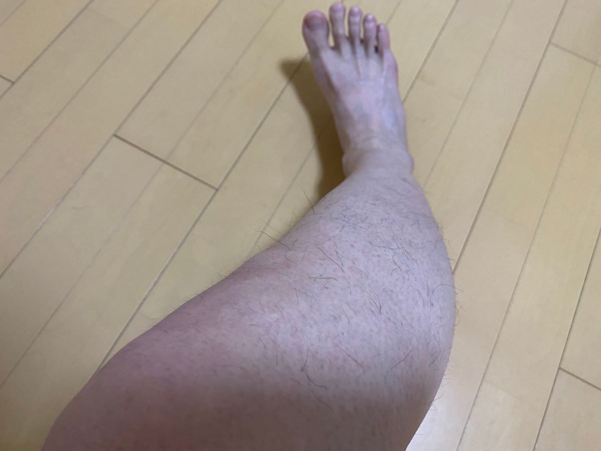 全身脱毛3回目の効果