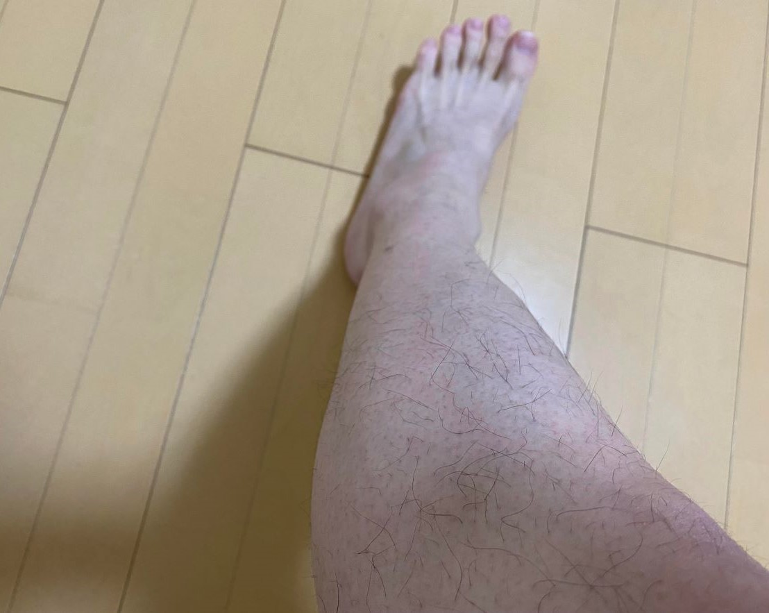 全身脱毛3回目の効果