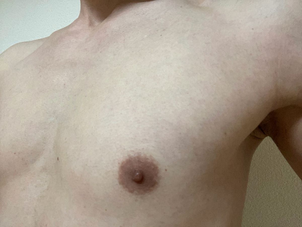 全身脱毛3回目の効果
