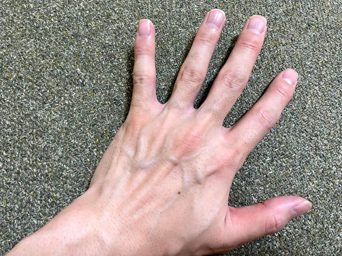 全身脱毛3回目の効果