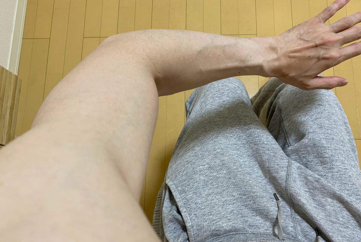 全身脱毛3回目の効果