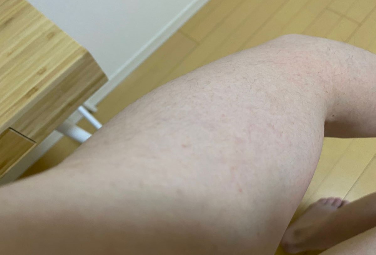 全身脱毛3回目の効果