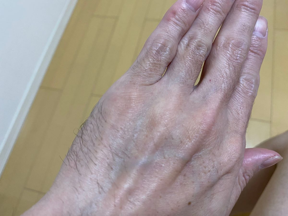 全身脱毛3回目の効果