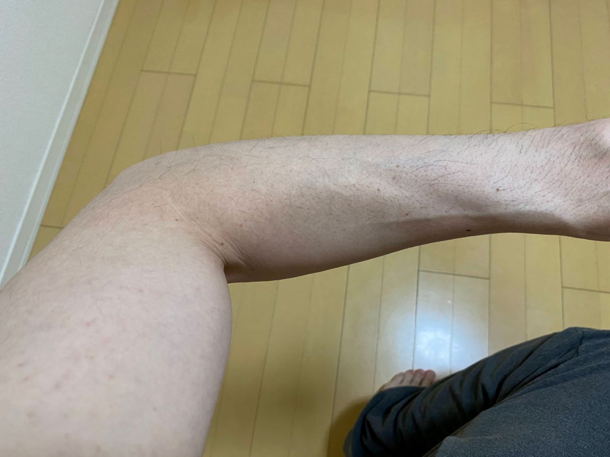 全身脱毛3回目の効果