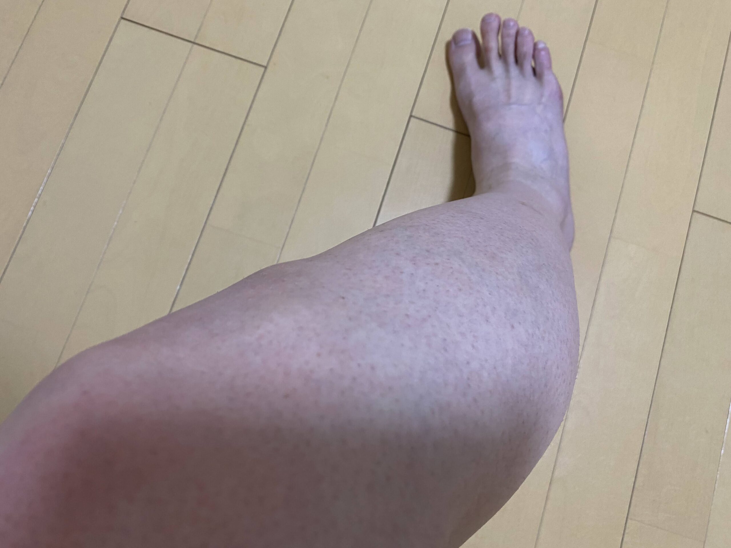 男の全身脱毛効果