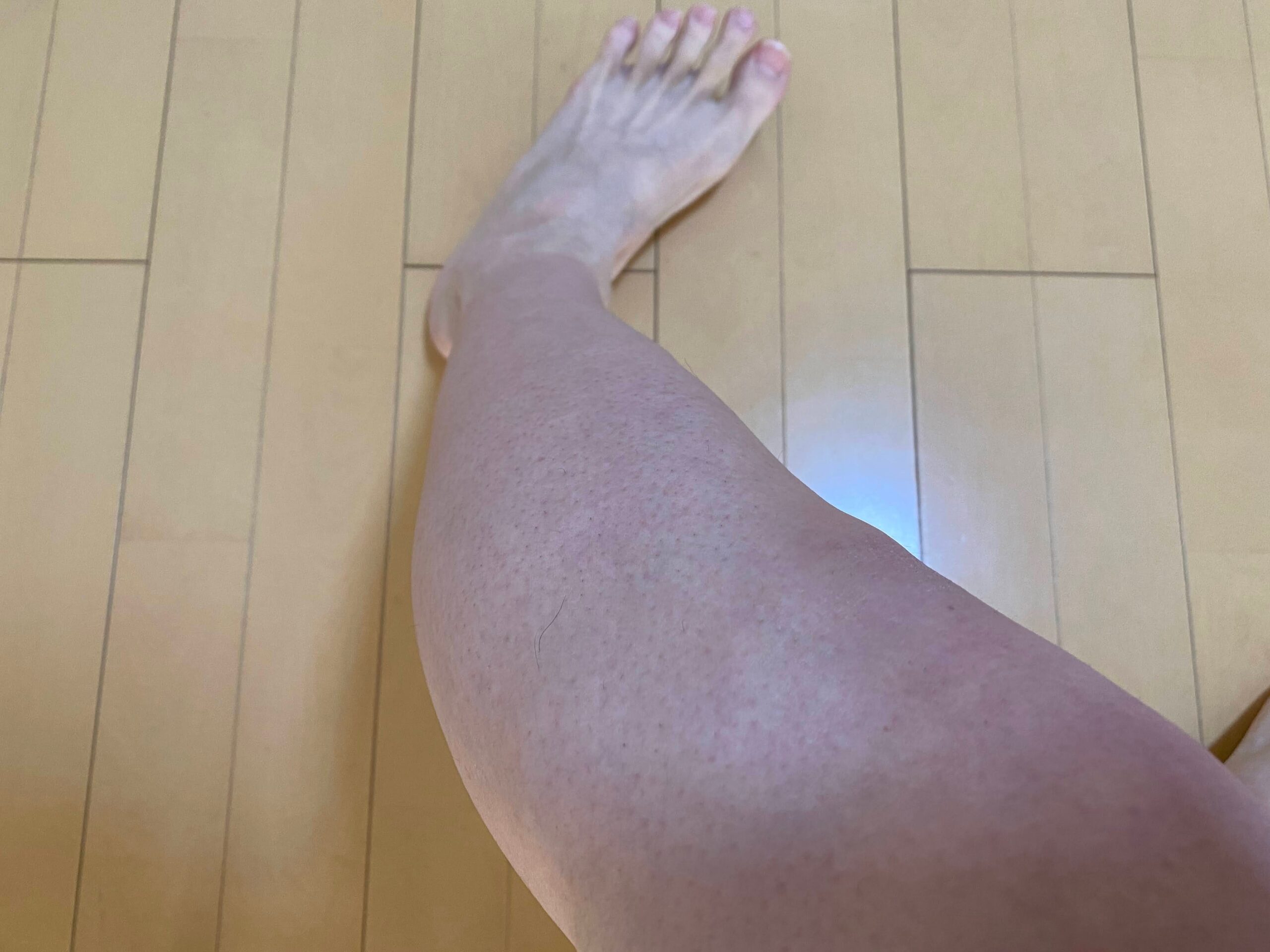男の全身脱毛効果