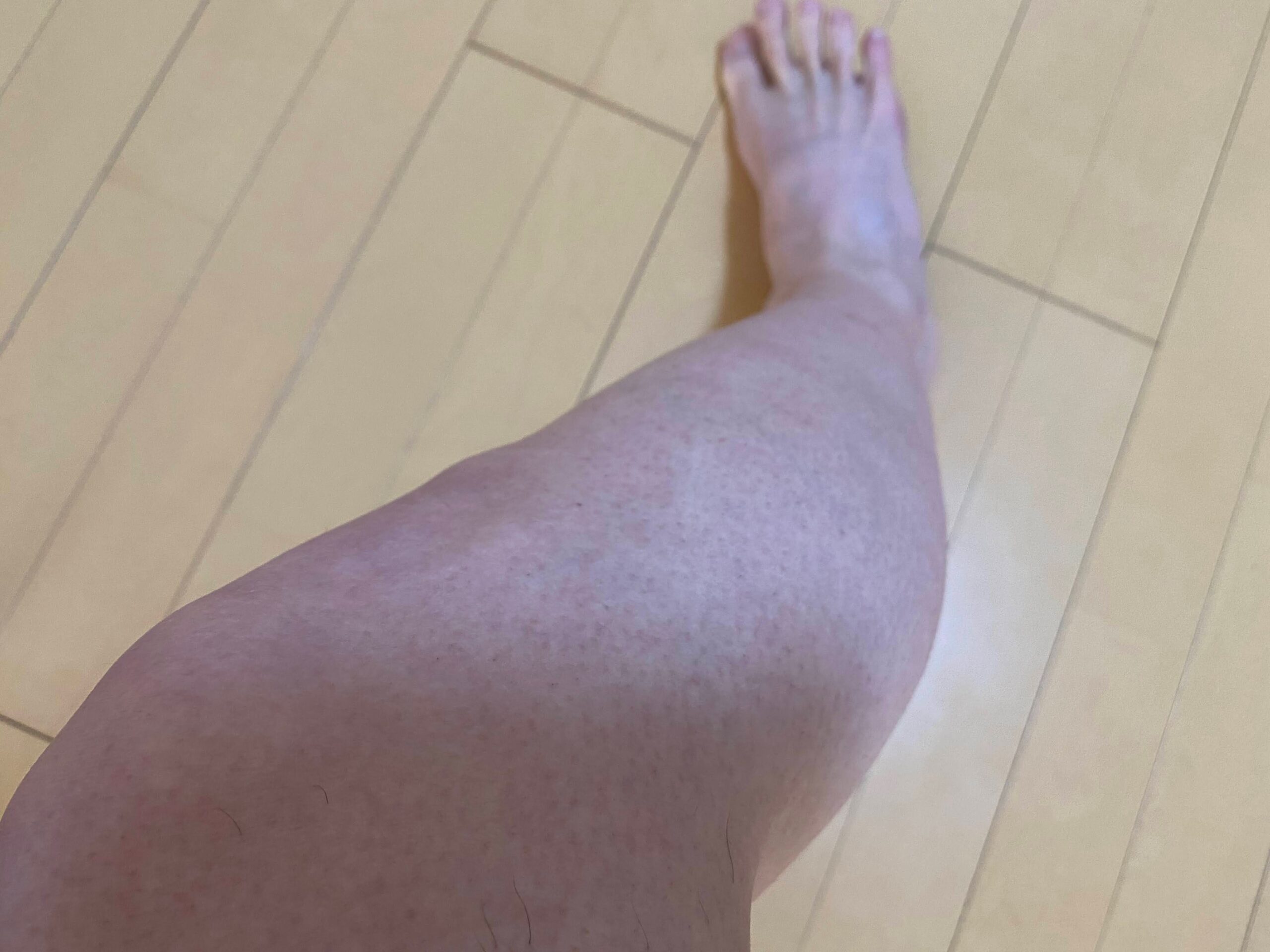 男の全身脱毛効果