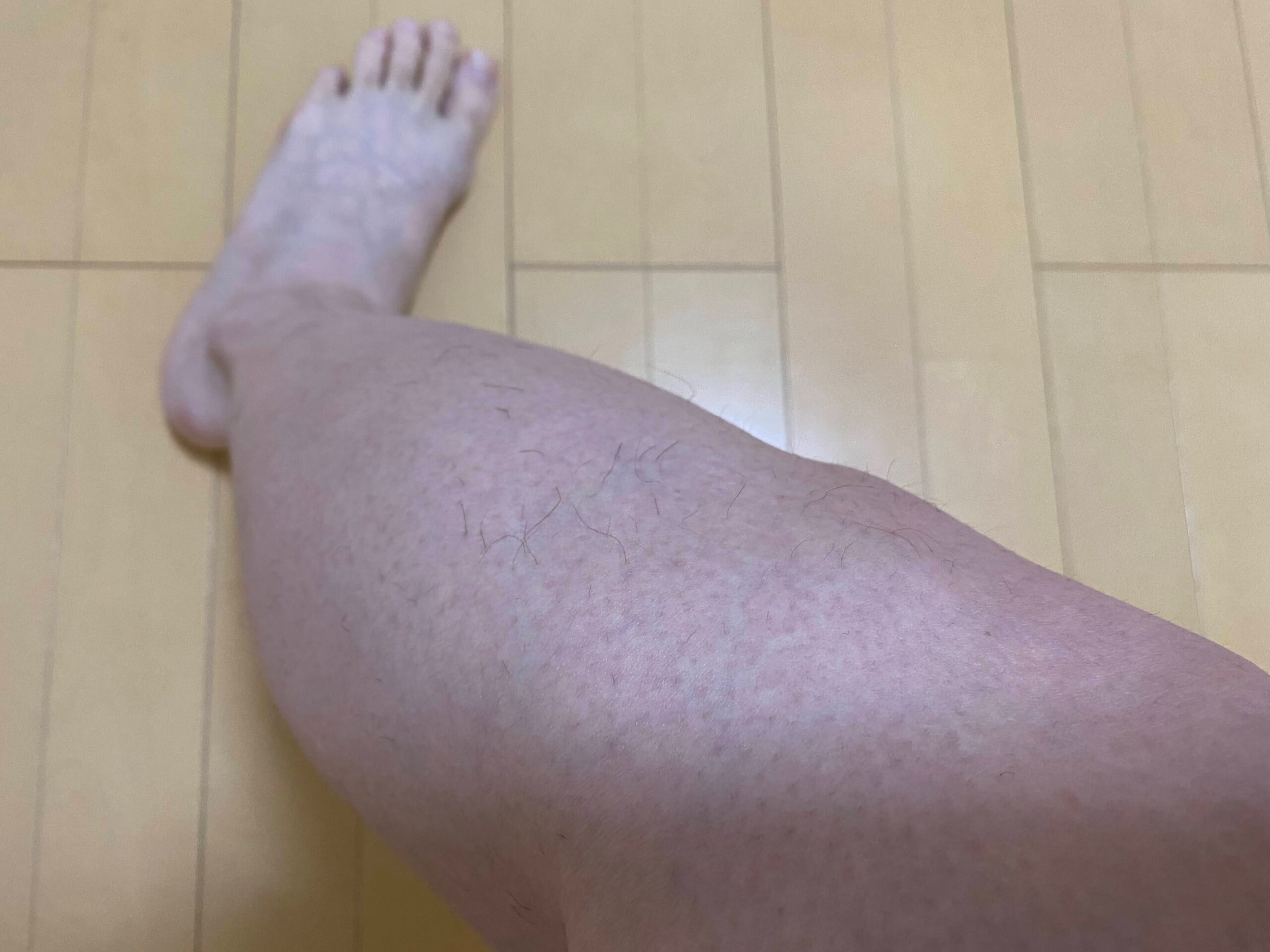 男の全身脱毛効果