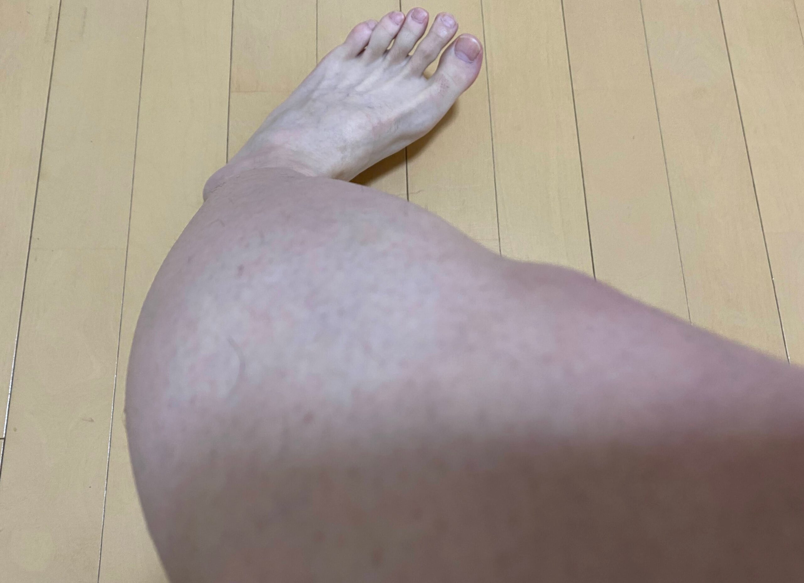 男の全身脱毛効果
