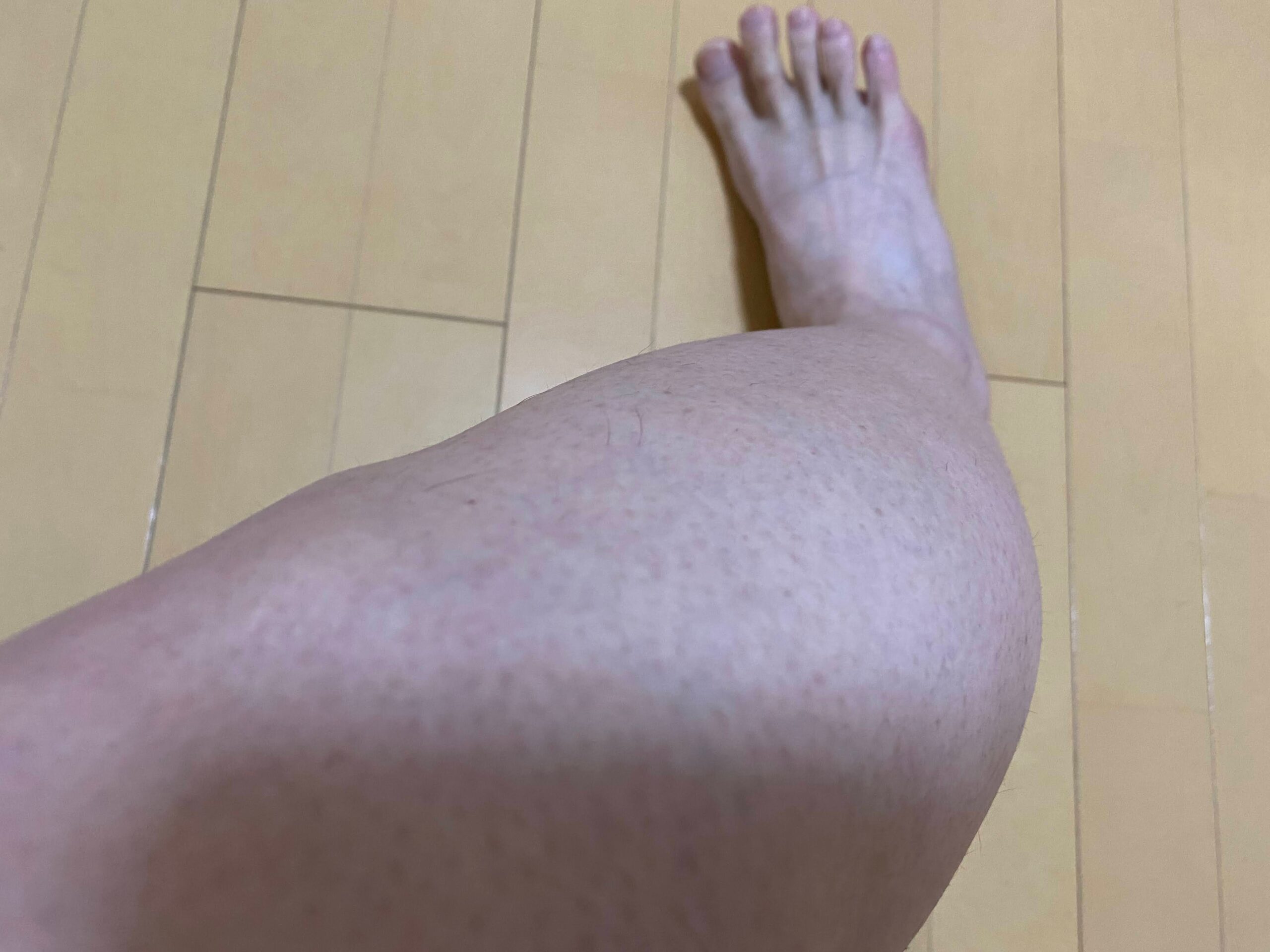 男の全身脱毛効果