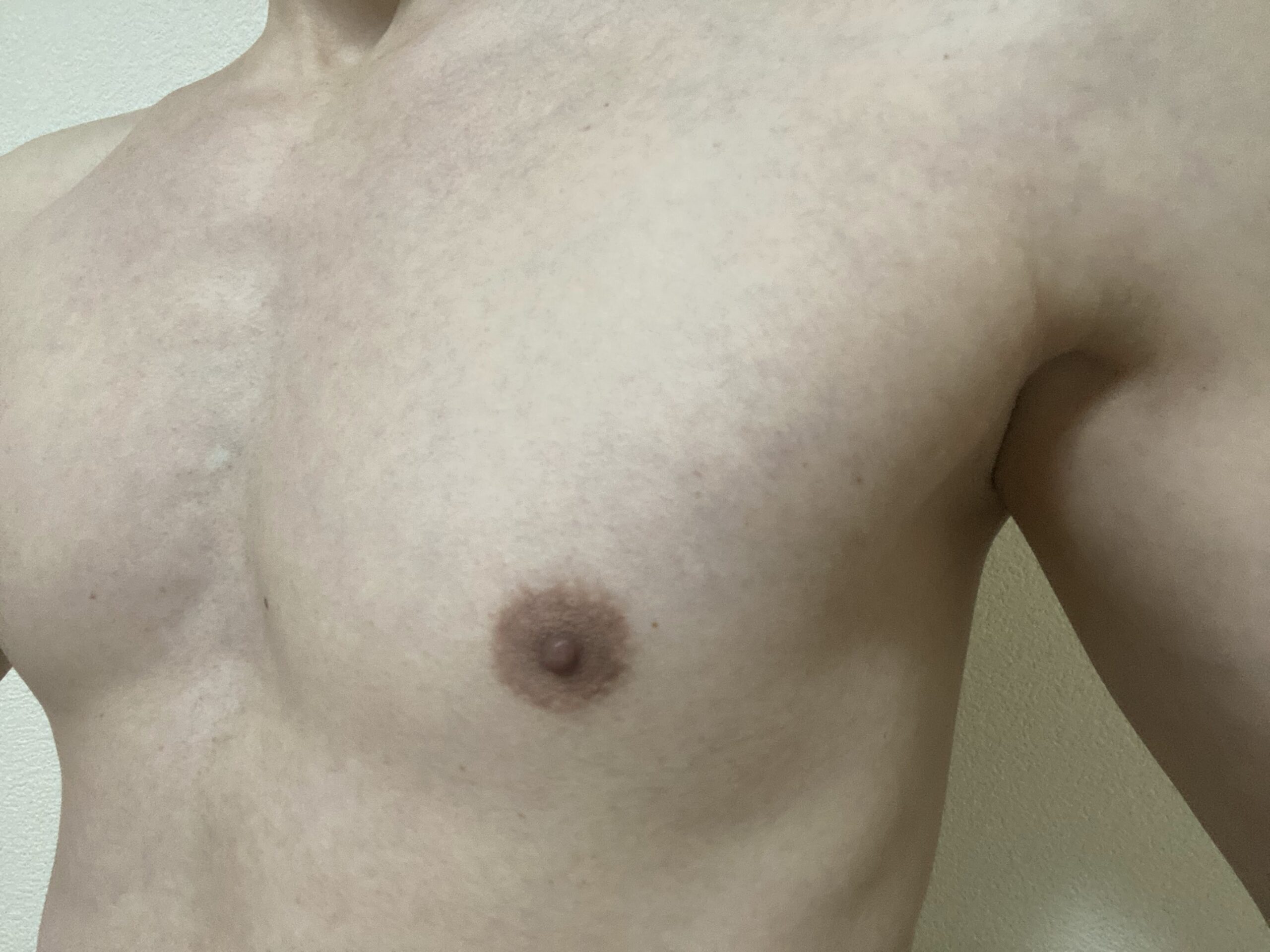 男の全身脱毛の効果