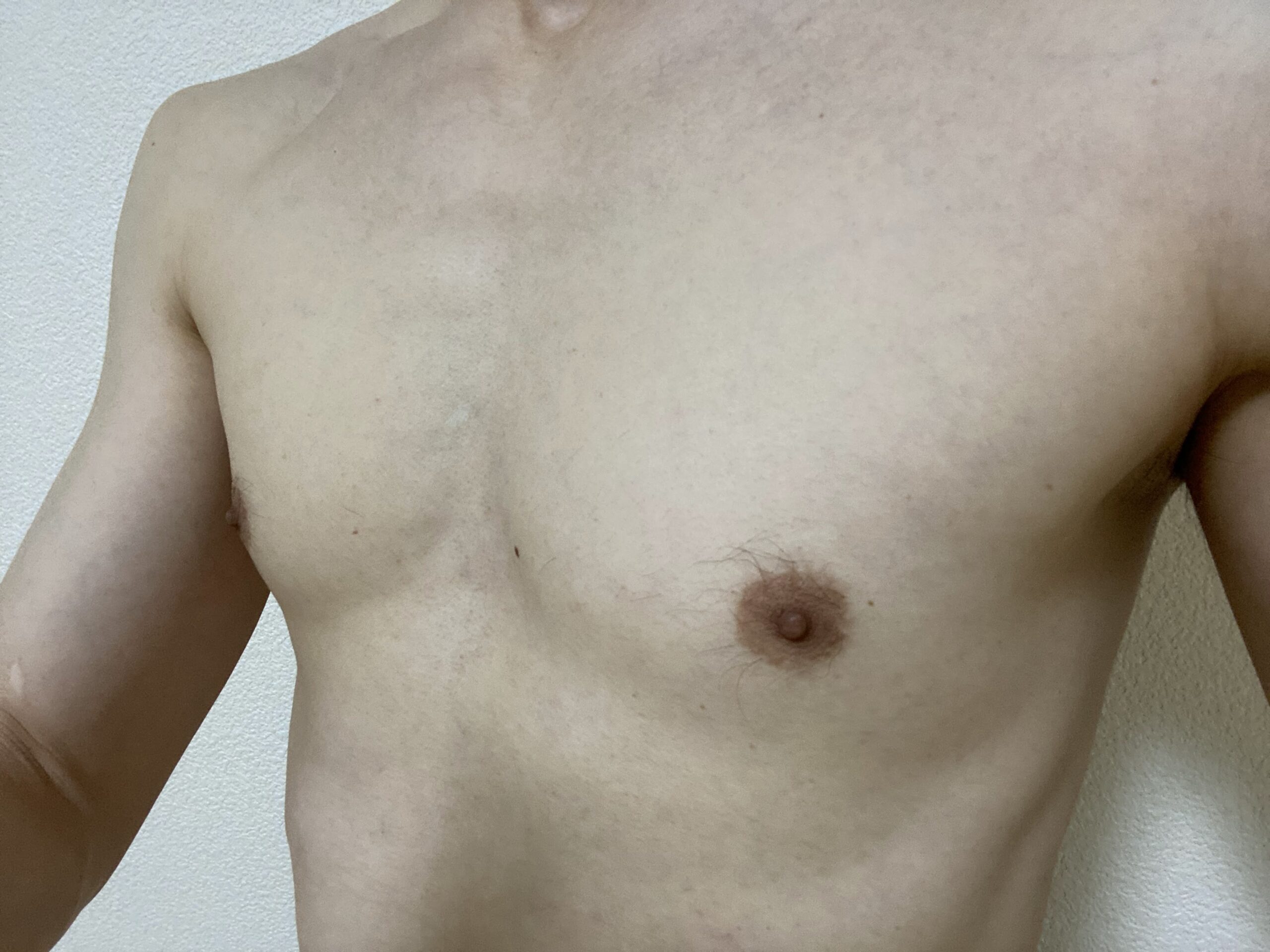 男の全身脱毛効果