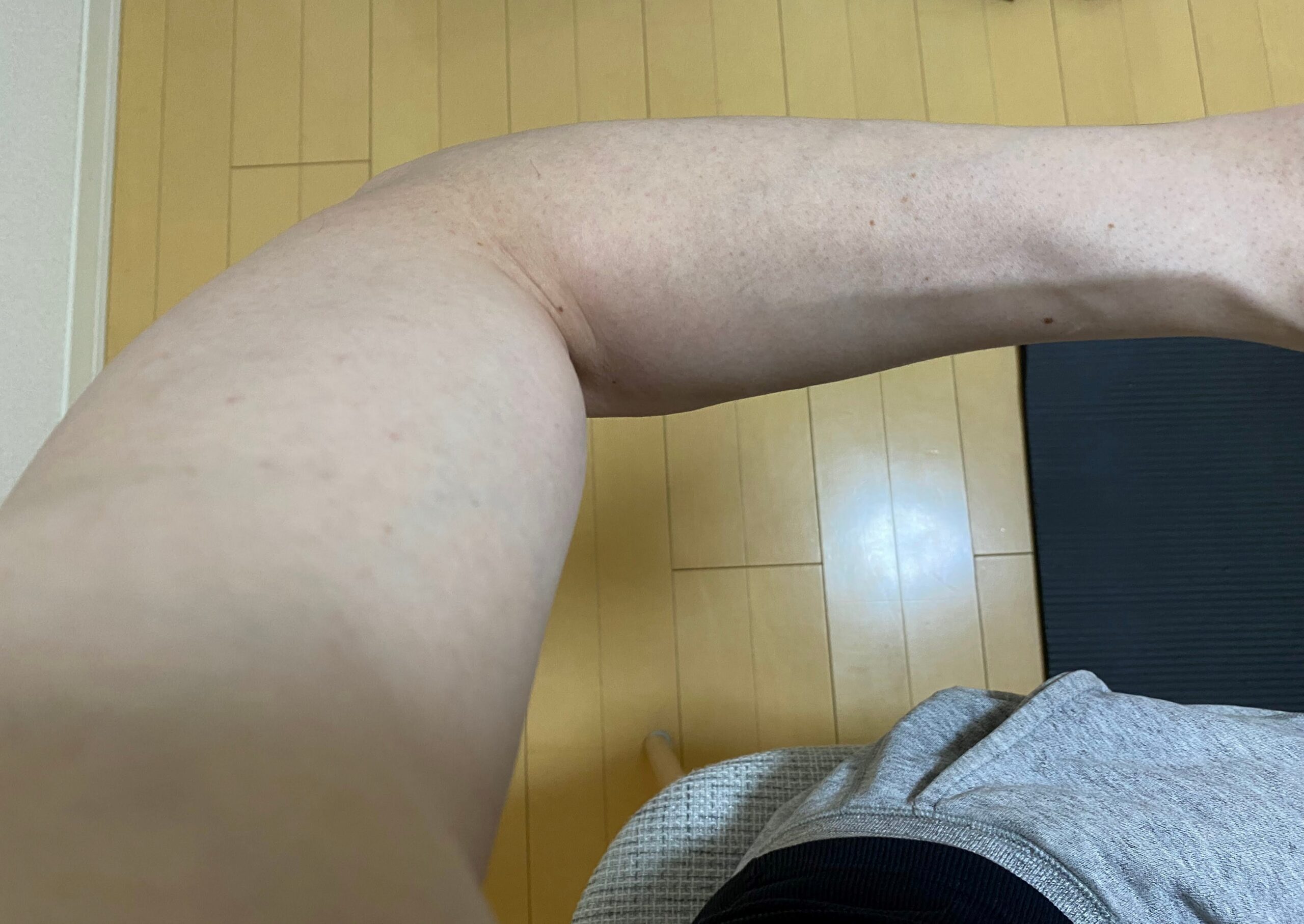 男の全身脱毛の効果