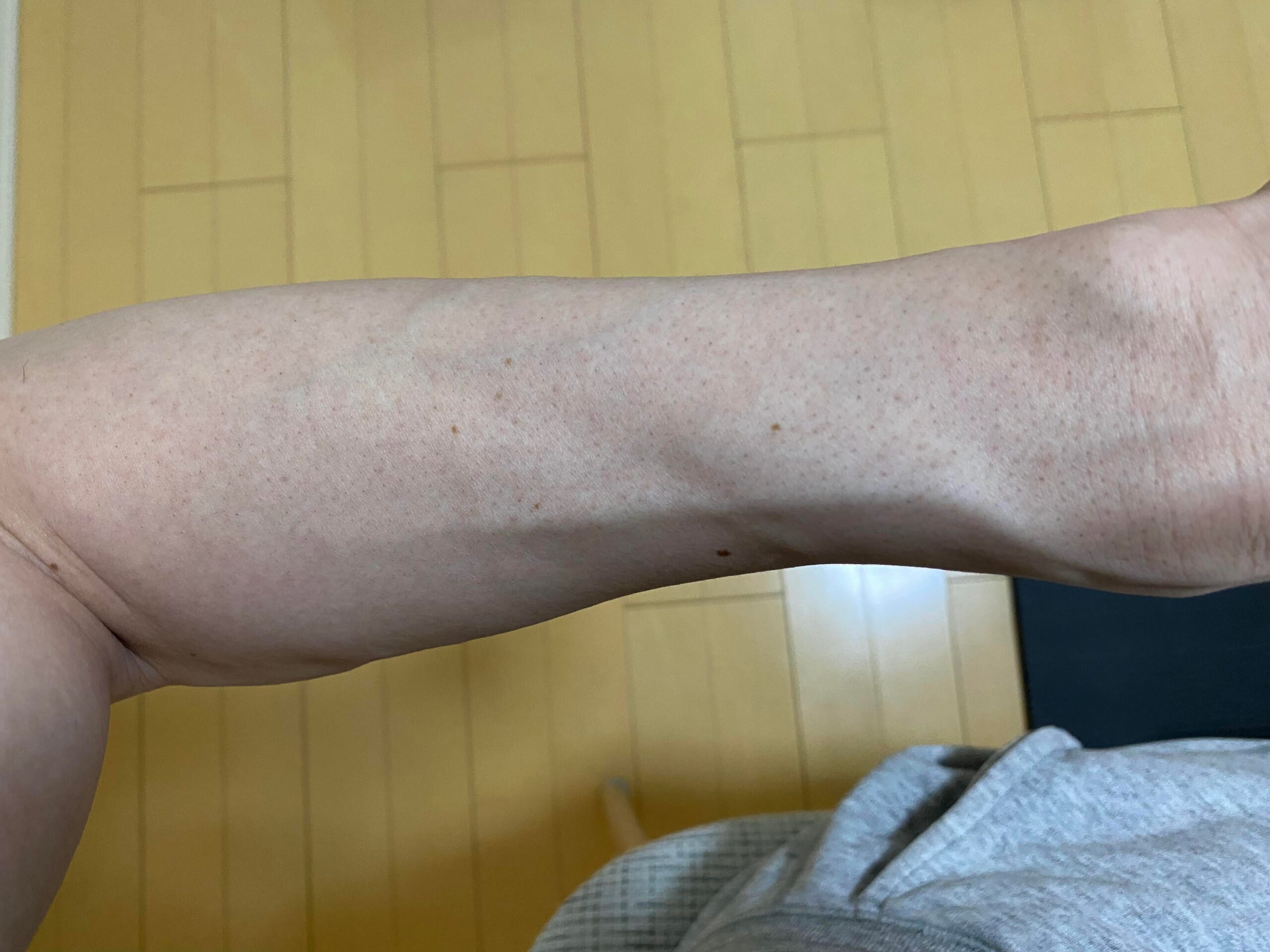 男の全身脱毛の効果