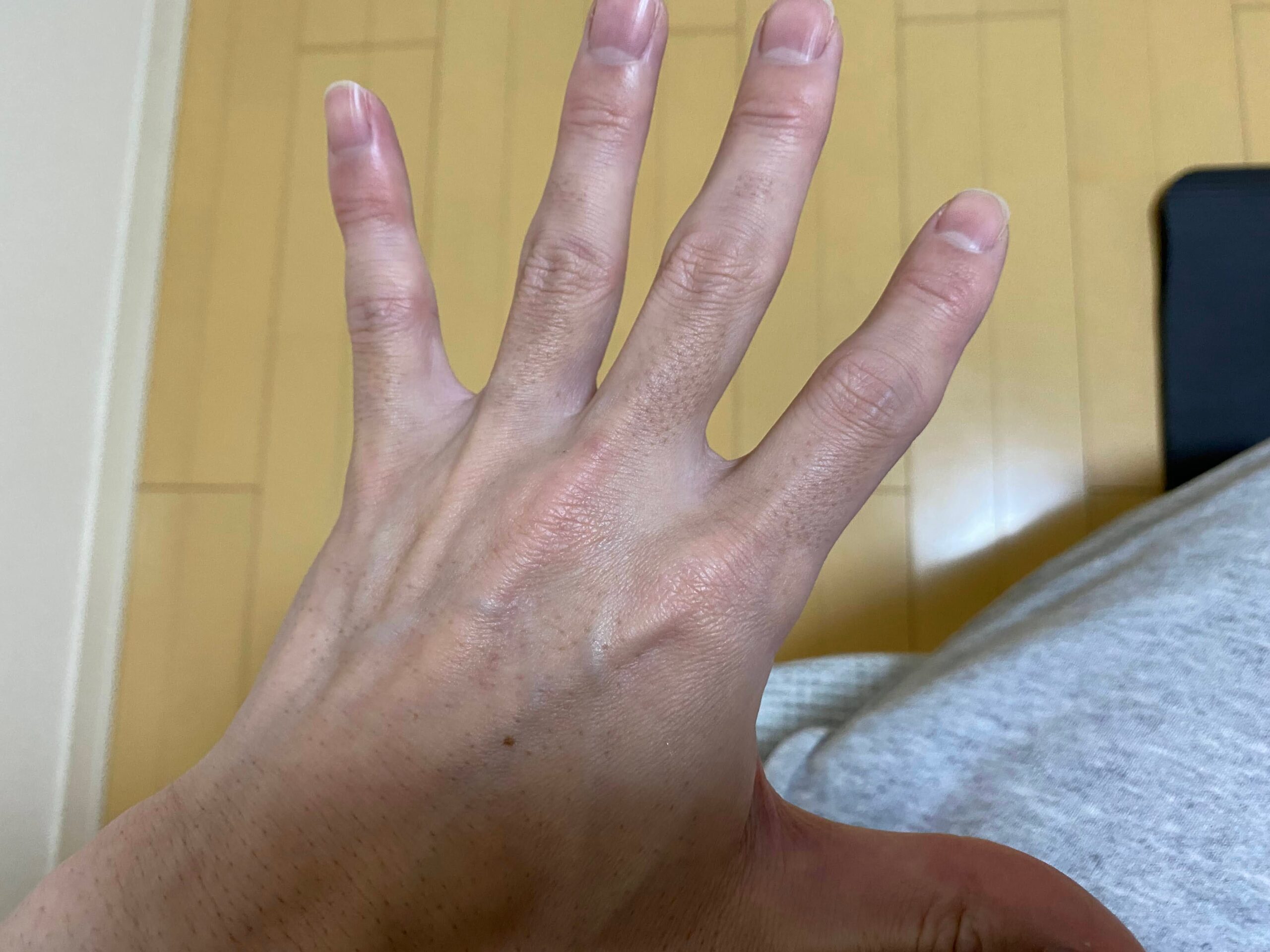 男の全身脱毛の効果