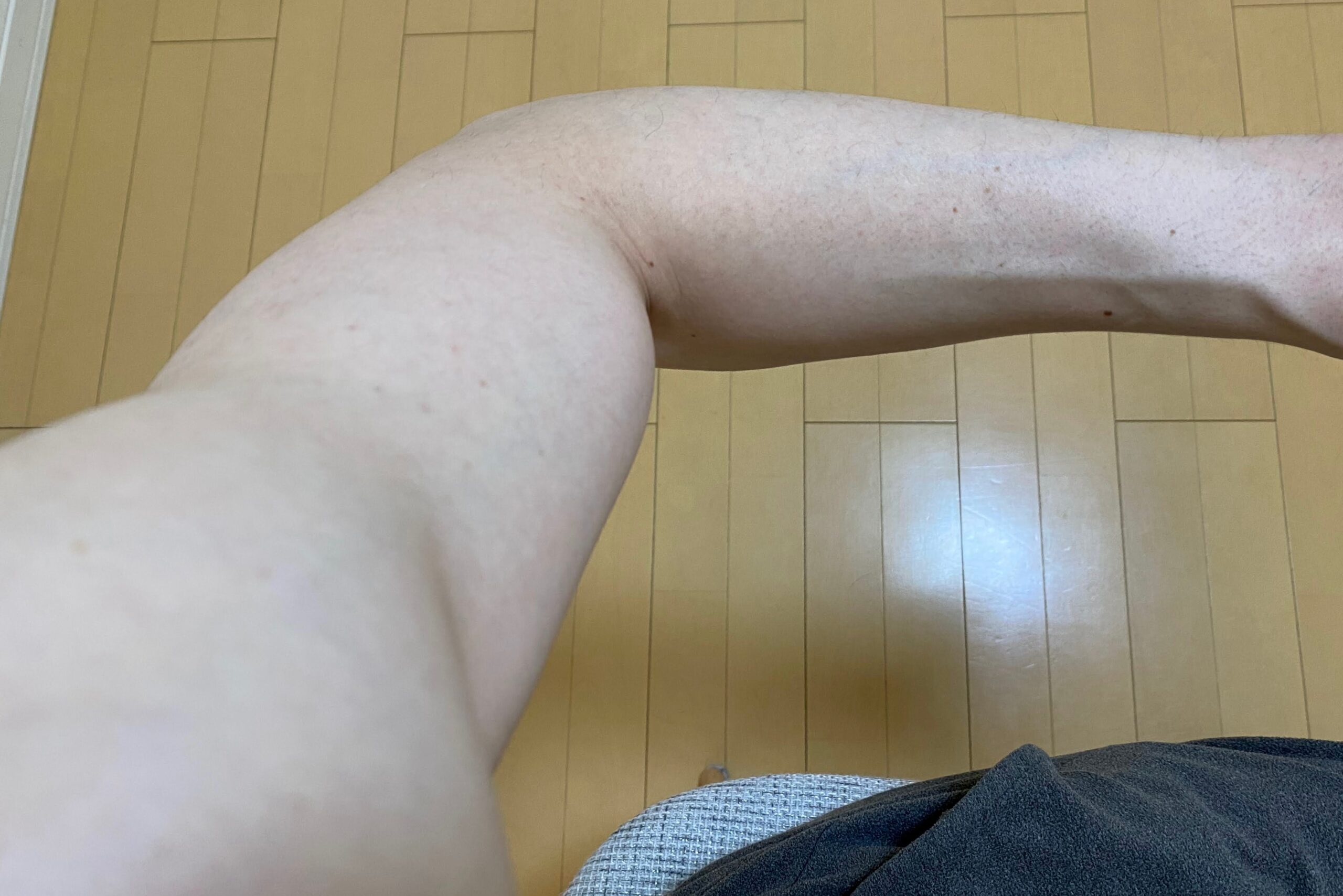 男の全身脱毛の効果