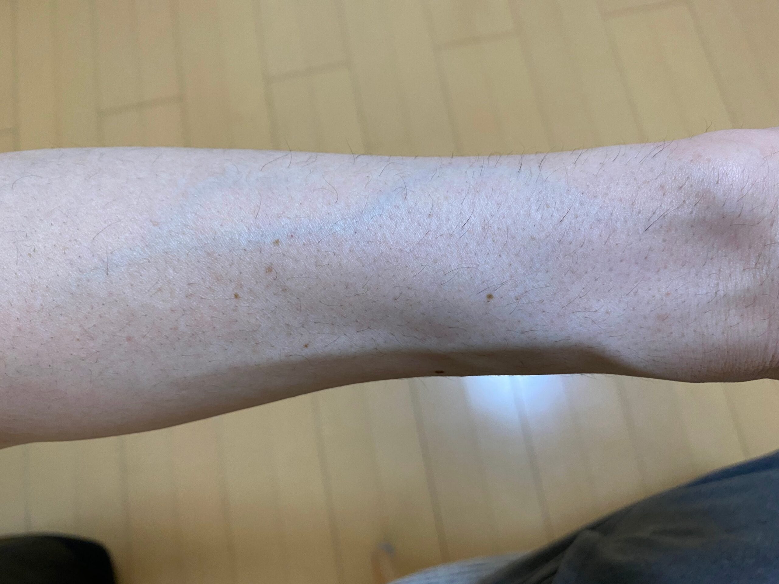 男の全身脱毛の効果
