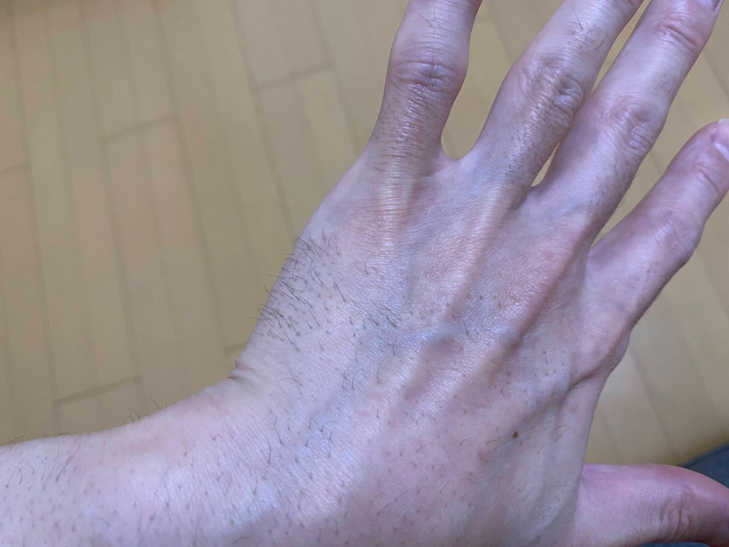 男の全身脱毛の効果