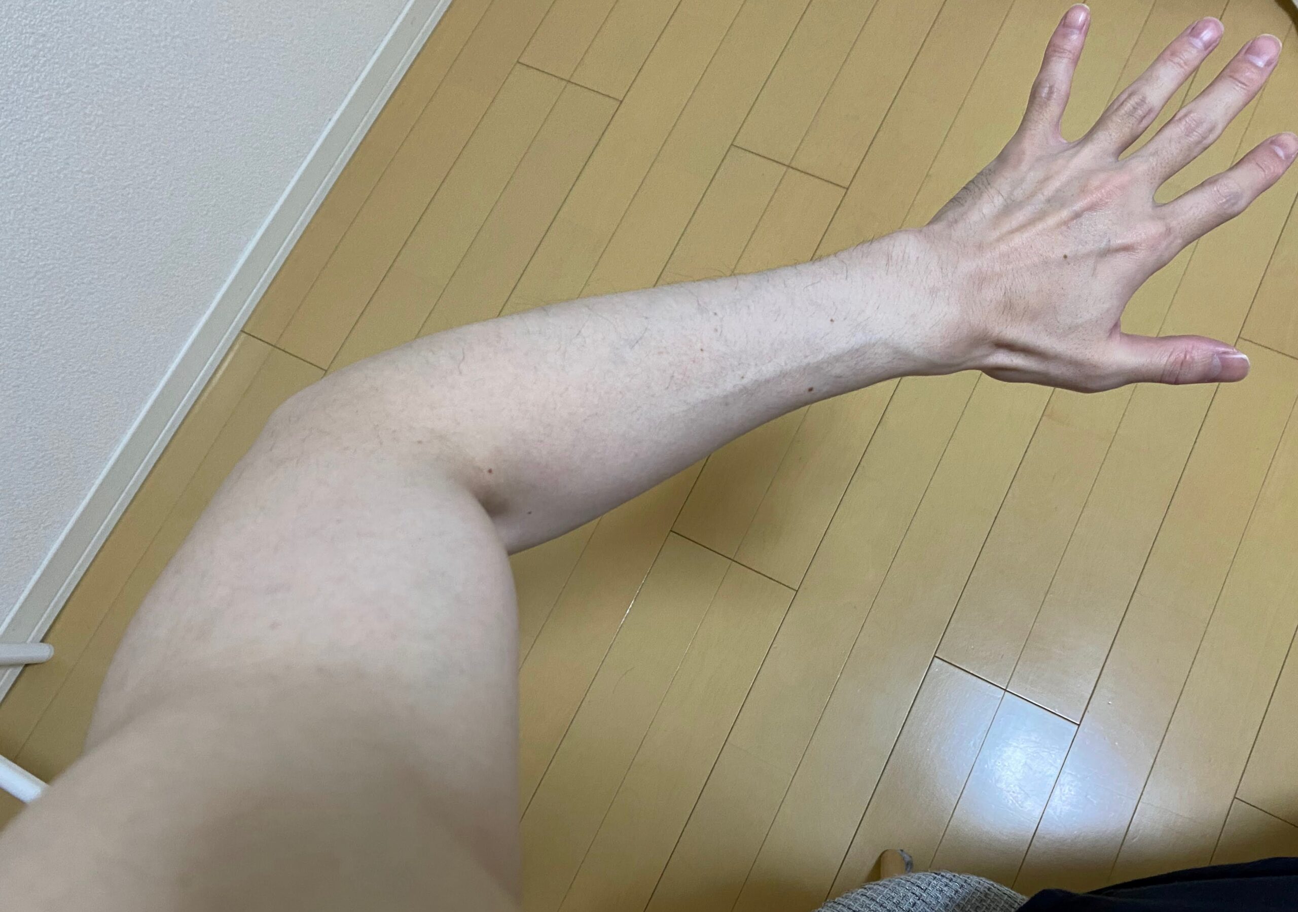 男の全身脱毛の効果