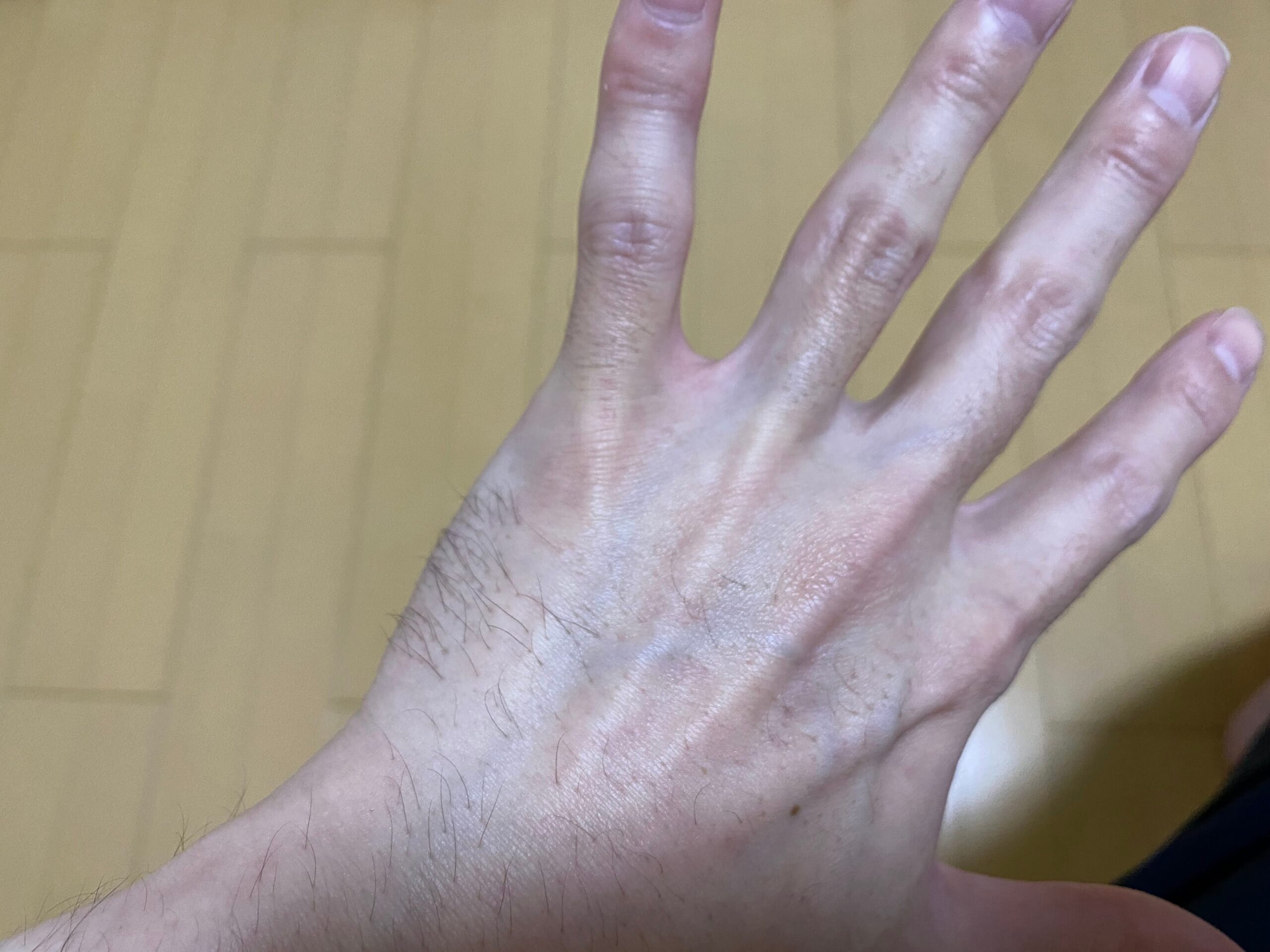 男の全身脱毛の効果
