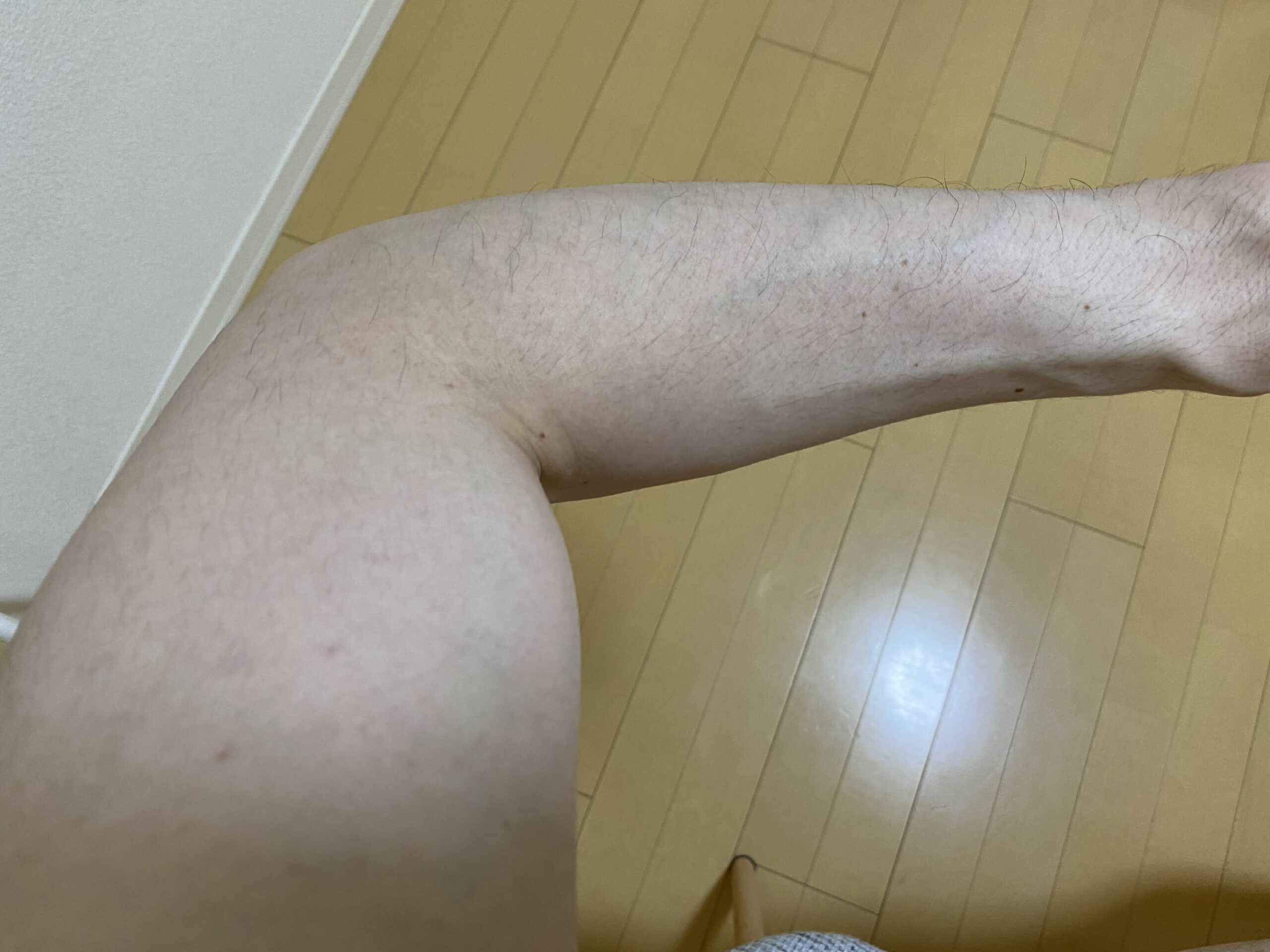 男の全身脱毛の効果