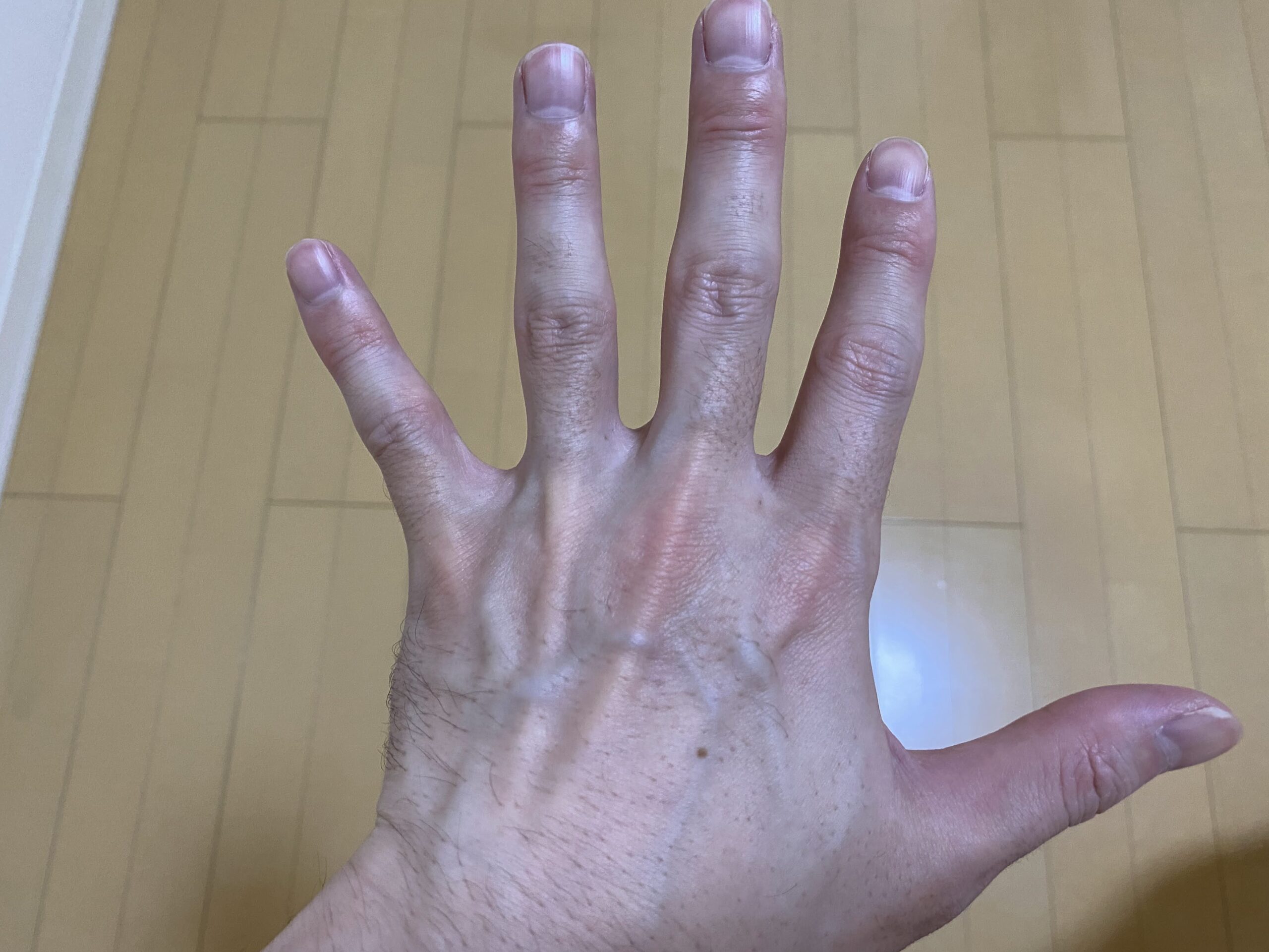 男の全身脱毛の効果