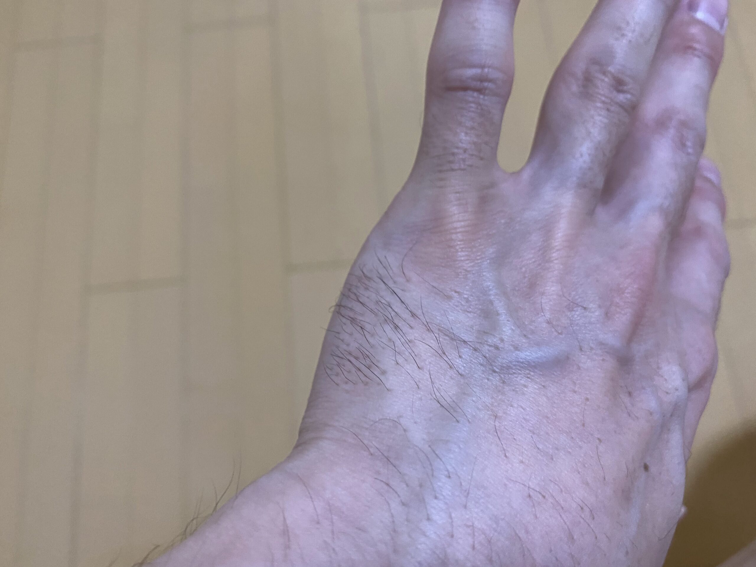 男の全身脱毛の効果